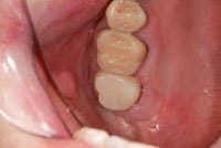 Th 0603wdjbra4 Th 0603wdjbra4