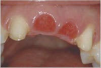 Th 0603wdjbra5 Th 0603wdjbra5