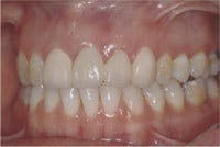 Th 0603wdjbra6 Th 0603wdjbra6