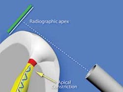 Th 0605dem Anewapex02 Th 0605dem Anewapex02