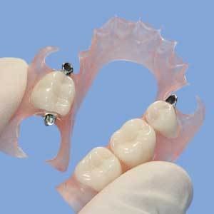 Th 0605dem Thermoplastics01