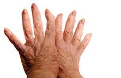 Th 0606wdj Arth01 Th 0606wdj Arth01