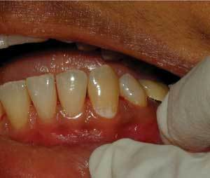 Th 0609dem Dentalequip01