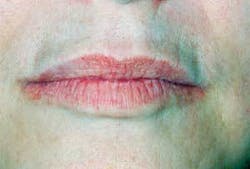 Th 0610wdj Lips01 Th 0610wdj Lips01