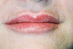 Th 0610wdj Lips02 Th 0610wdj Lips02