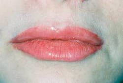 Th 0610wdj Lips04 Th 0610wdj Lips04