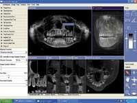 Th 0610wdj Prod02 Th 0610wdj Prod02