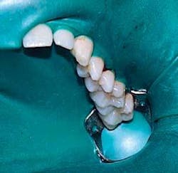 Th 0611wdj Aerosols04 Th 0611wdj Aerosols04