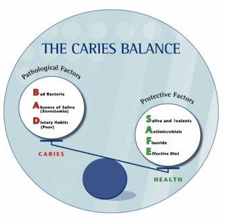 Th 0701wdjtreatingcaries01