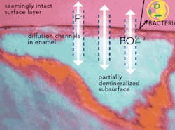Th 0701wdjtreatingcaries02 Th 0701wdjtreatingcaries02