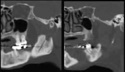 Th 0703wdjnecrosis03 Th 0703wdjnecrosis03