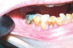 Th 0703wdjnecrosis04 Th 0703wdjnecrosis04