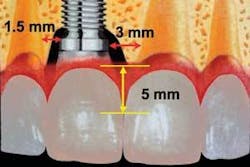 Th 0707wdjimmediate02 Th 0707wdjimmediate02