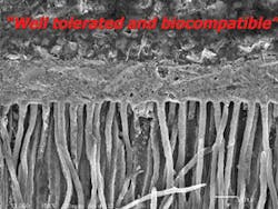 Th 0709do Rootcanal02 Th 0709do Rootcanal02