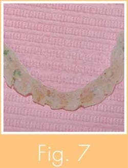 Th 0711wdjimplant05 Th 0711wdjimplant05