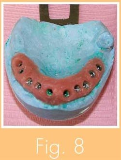 Th 0711wdjimplant06 Th 0711wdjimplant06