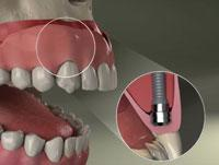 james harden teeth and feet