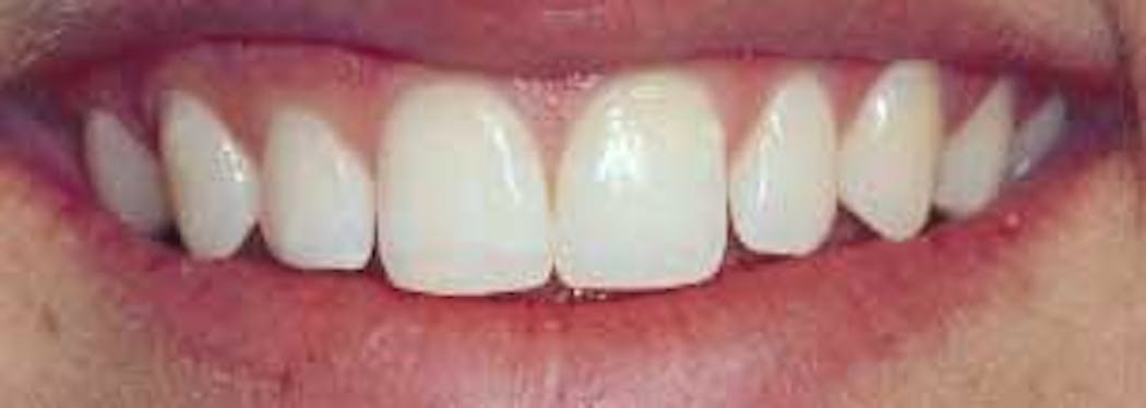 Th 132833