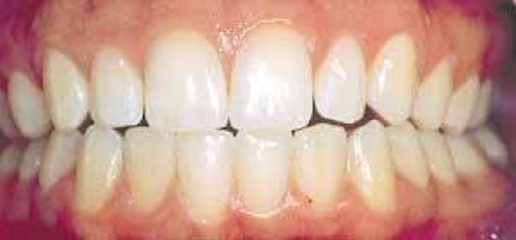 Th 132834