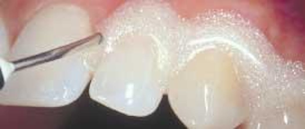 Th 132835