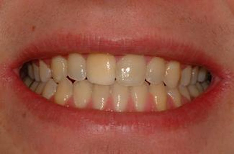 Th 132848