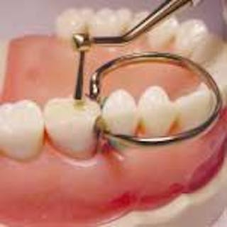 Dental Tip Out Bins, GP, Ortho, Perio