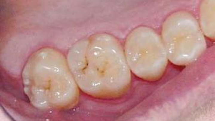 Th 137808