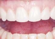 Th 142313 Th 142313