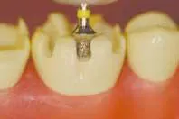 Th 154655