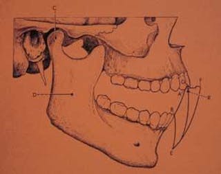 The missing factor in cosmetic dentistry - occlusion | Dentistry IQ