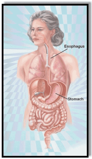 Understanding Acid Reflux And Its Dental Manifestations Dentistryiq acid reflux and its dental