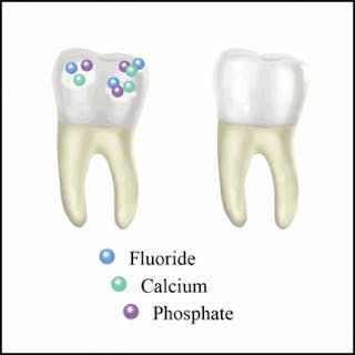 Step-by-Step Dental Filling Procedure: How Does It Work? - Mint