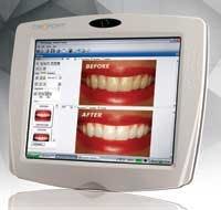 Th Equipf06 Th Equipf06