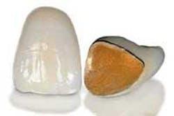 Th Frenchf1 Th Frenchf1