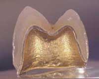 Th Frenchf3 Th Frenchf3