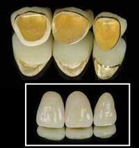 Th Frenchf5 Th Frenchf5