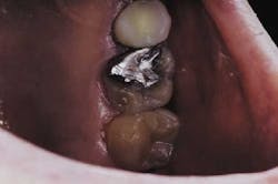 Th Garrison 03 Th Garrison 03