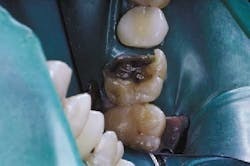 Th Garrison 04 Th Garrison 04