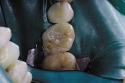 Th Garrison 11 Th Garrison 11