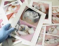 Th Goldstein Pt Ed Oct Th Goldstein Pt Ed Oct