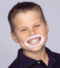 Th Ivocla1 Th Ivocla1