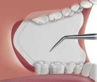 Th Microcopy Superabsorber Th Microcopy Superabsorber