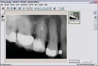 Th P0602wdjeasy X Ray Th P0602wdjeasy X Ray