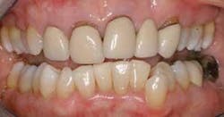 Th Patient A Th Patient A