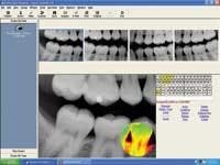 Th Patterson Imaging Jan Th Patterson Imaging Jan