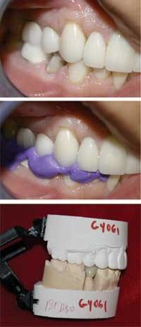 Th Simonf2 Th Simonf2