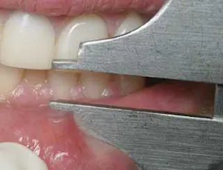Tips from the lab | Dentistry IQ