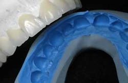 Th Wax Siltek Th Wax Siltek