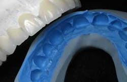 Th Wax Siltek Th Wax Siltek