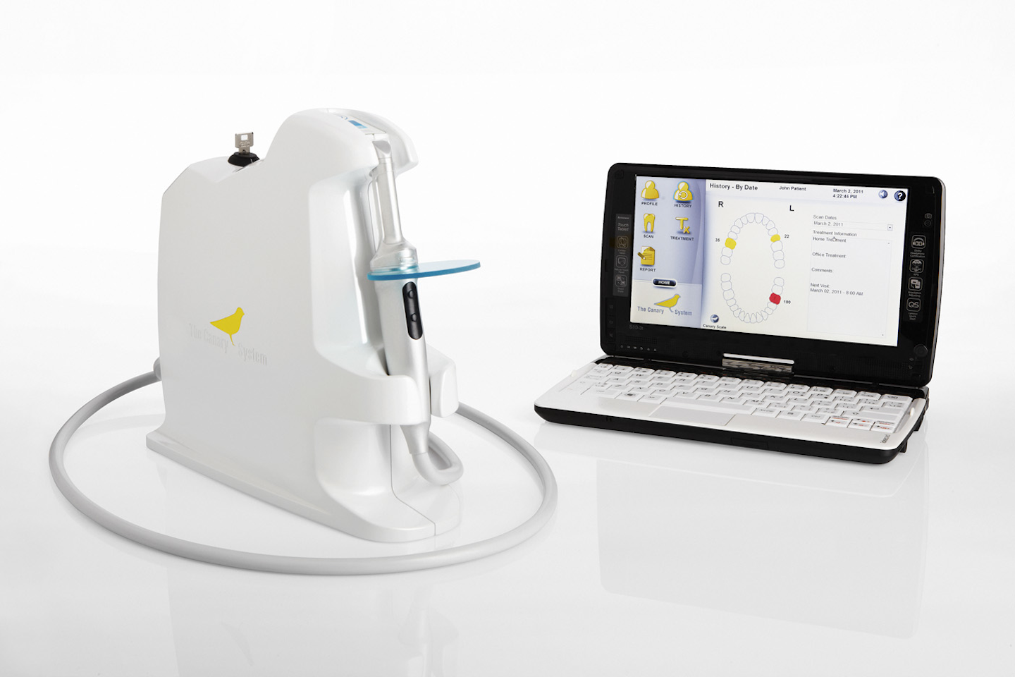 Review: The Canary System by Quantum Dental Technologies | DentistryIQ